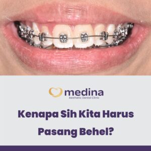 Behel Klinik Gigi Jepara Medina