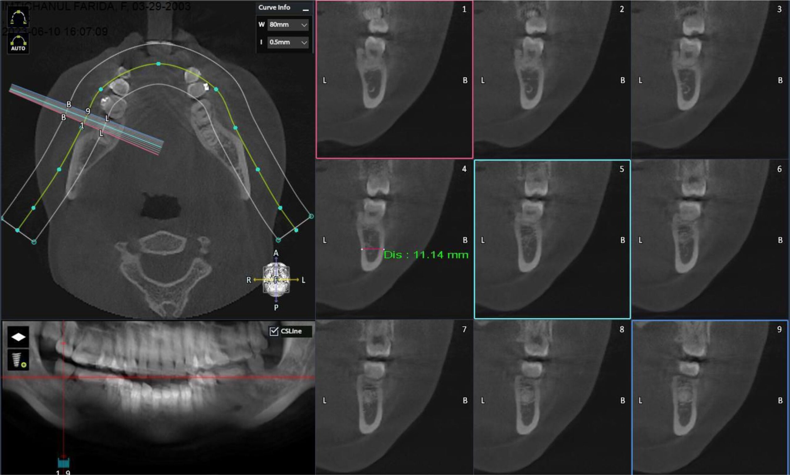 RONTGEN CBCT KLINIK GIGI JEPARA MEDINA