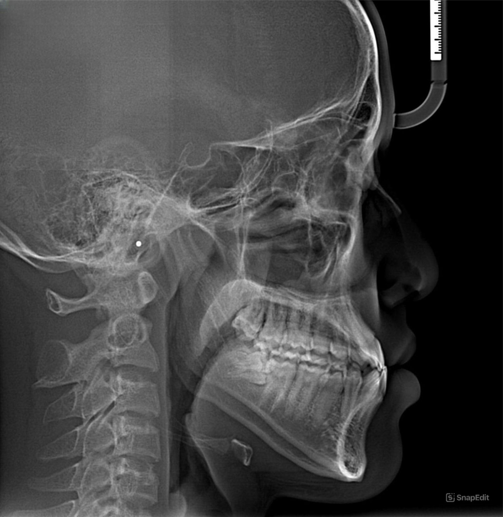 RONTGEN LATERAL CEPALOMATRIC KLINIK GIGI JEPARA MEDINA