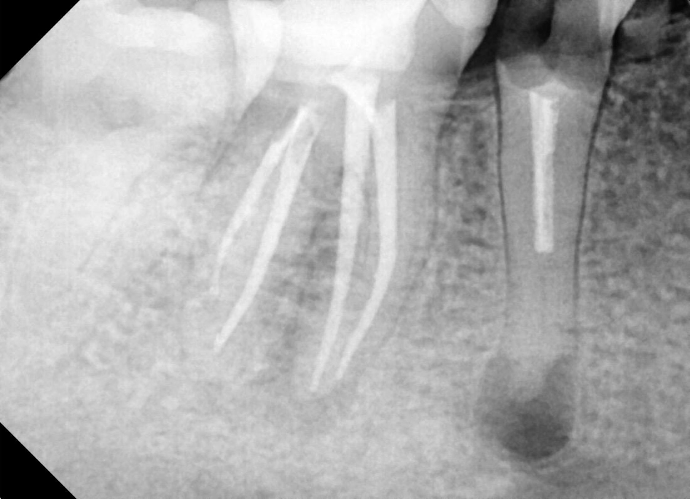 RONTGEN PERIAPICAL KLINIK GIGI JEPARA MEDINA