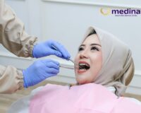 APAKAH CABUT GIGI BUNGSU WAJIB DILAKUKAN? – KLINIK GIGI JEPARA MEDINA