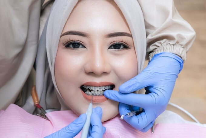 KENAPA BRACKET SERING LEPAS? KLINIK GIGI JEPARA MEDINA