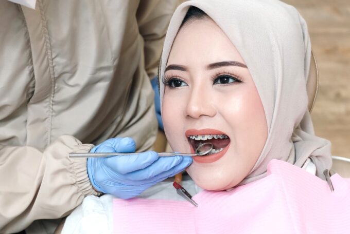 PASANG BEHEL ATAS ATAU BAWAH AJA APAKAH BOLEH? KLINIK GIGI MEDINA JEPARA