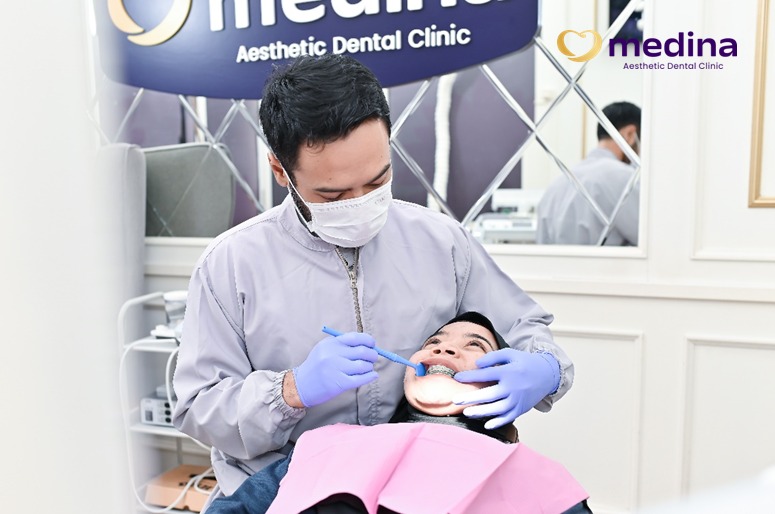 PASANG BEHEL JEPARA