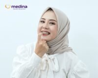 BEHEL KAMU MUDAH LEPAS?