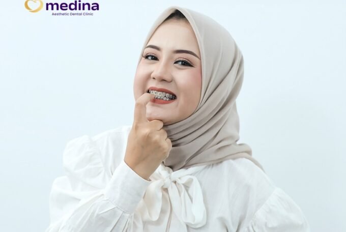 BEHEL KAMU MUDAH LEPAS?