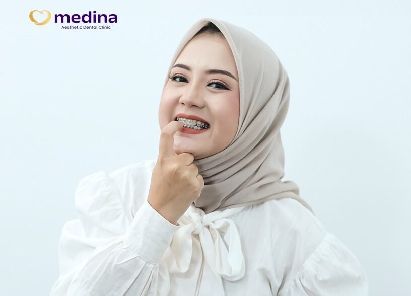 TIPS MEMILIH BEHEL KLINIK GIGI JEPARA MEDINA