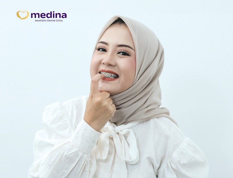 TIPS MEMILIH BEHEL KLINIK GIGI JEPARA MEDINA