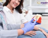 KENAPA HARUS IMPLAN GIGI?