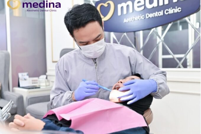 APAKAH PASANG BEHEL HARUS CABUT GIGI?