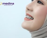 UMUR 10 TAHUN SUDAH PASANG BEHEL?