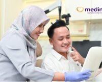 GIGI DEPAN RAPI, TAPI GIGI BELAKANG BERANTAKAN? 